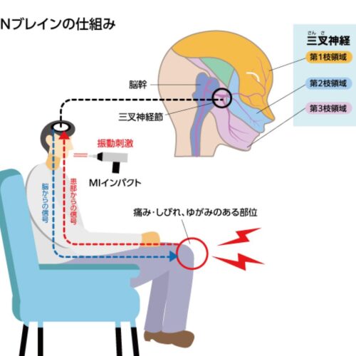 TNブレイン療法について