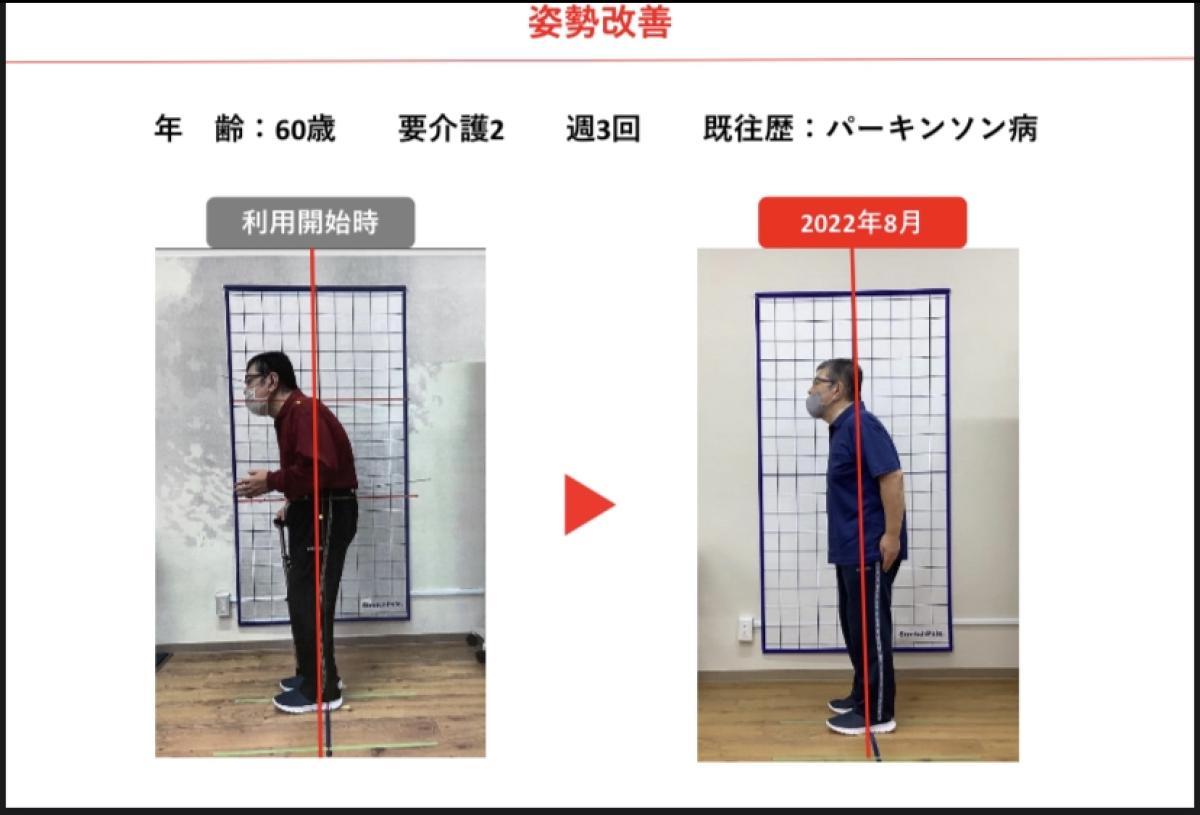 ご利用者様の声　ほねつぎデイサービス観音